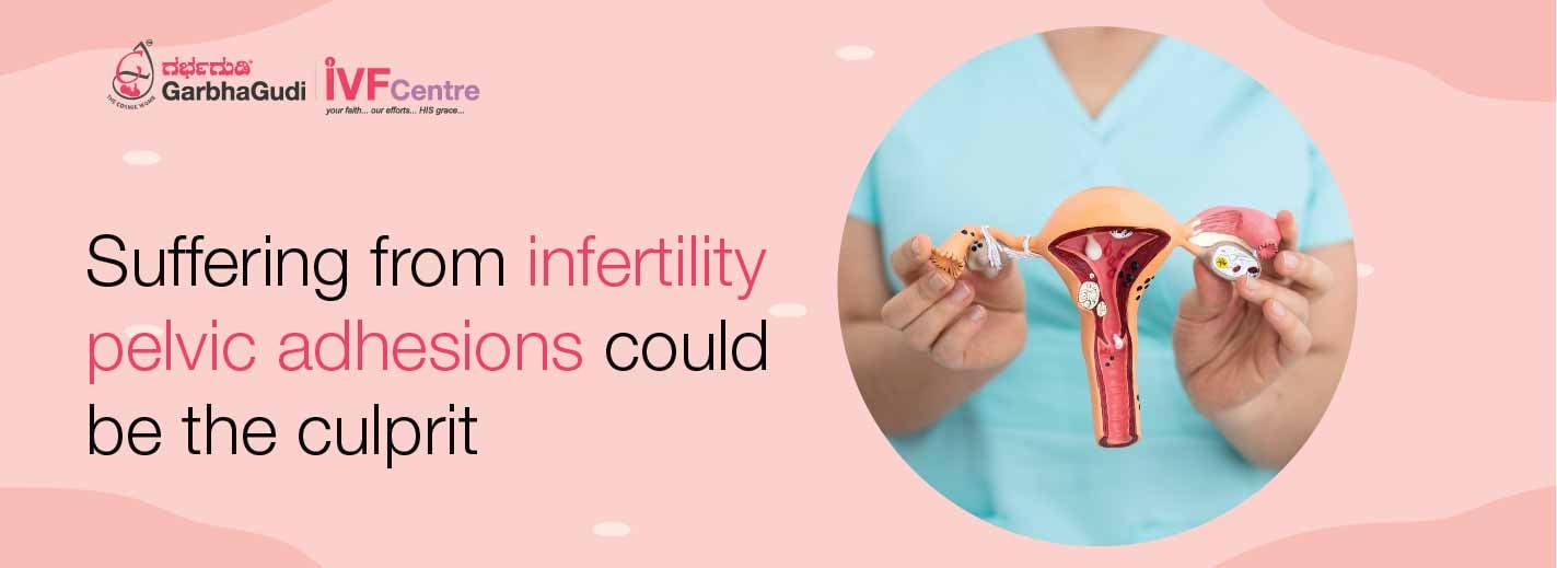 Pelvic Adhesions & Infertility: Causes & Symptoms | GarbhaGudi