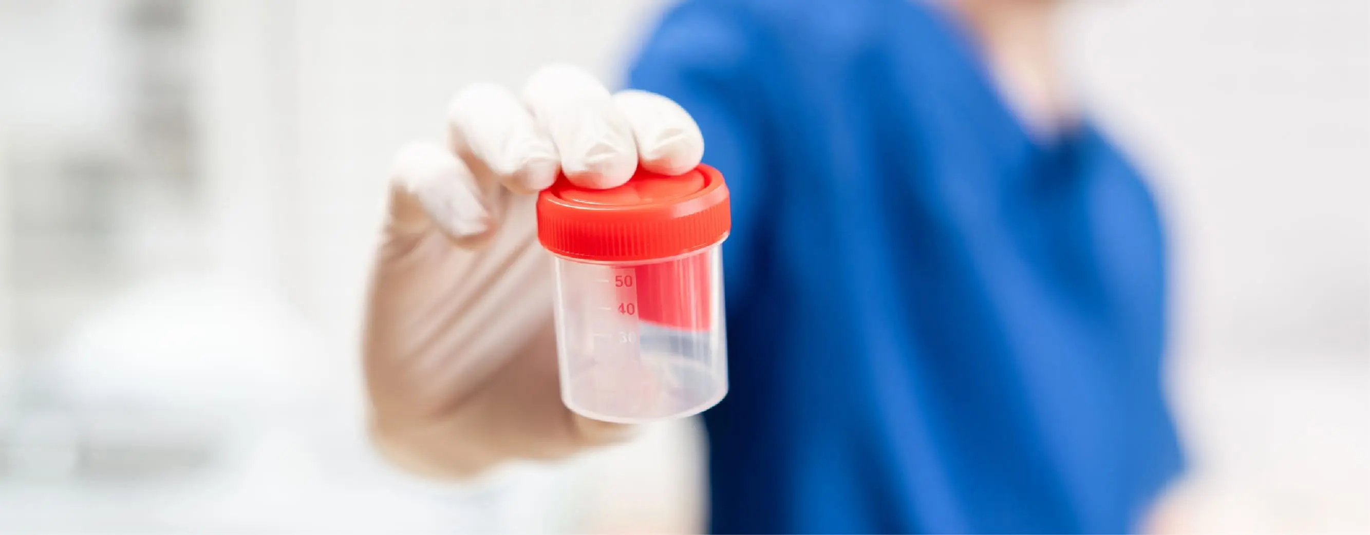 semen-analysis-test-in-bangalore