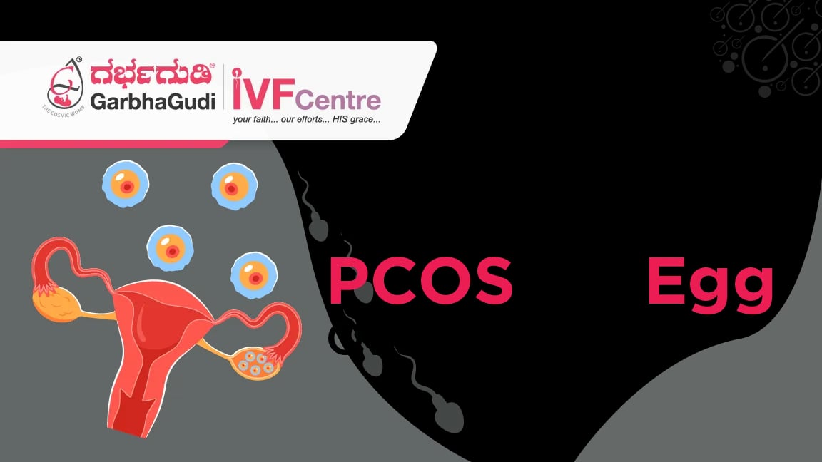The Connection Between PCOS and Egg Quality: How to Improve Fertility