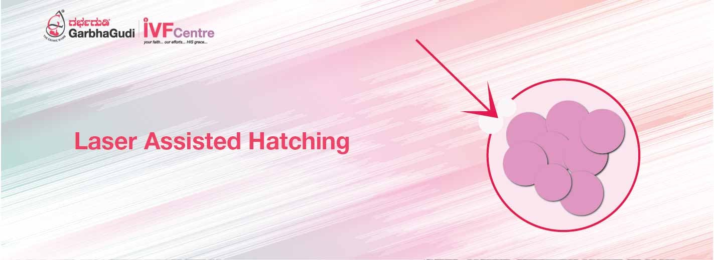Laser Assisted Hatching