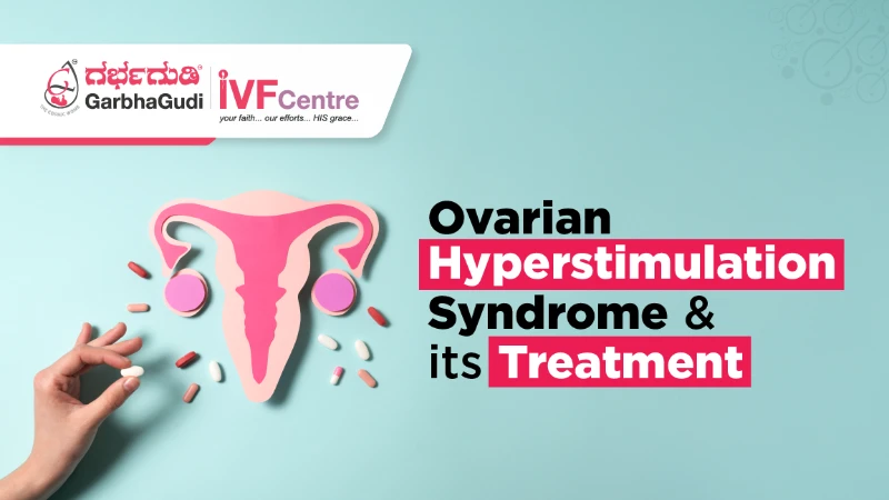 What Is Ovarian Hyperstimulation Syndrome? A Complete Guide