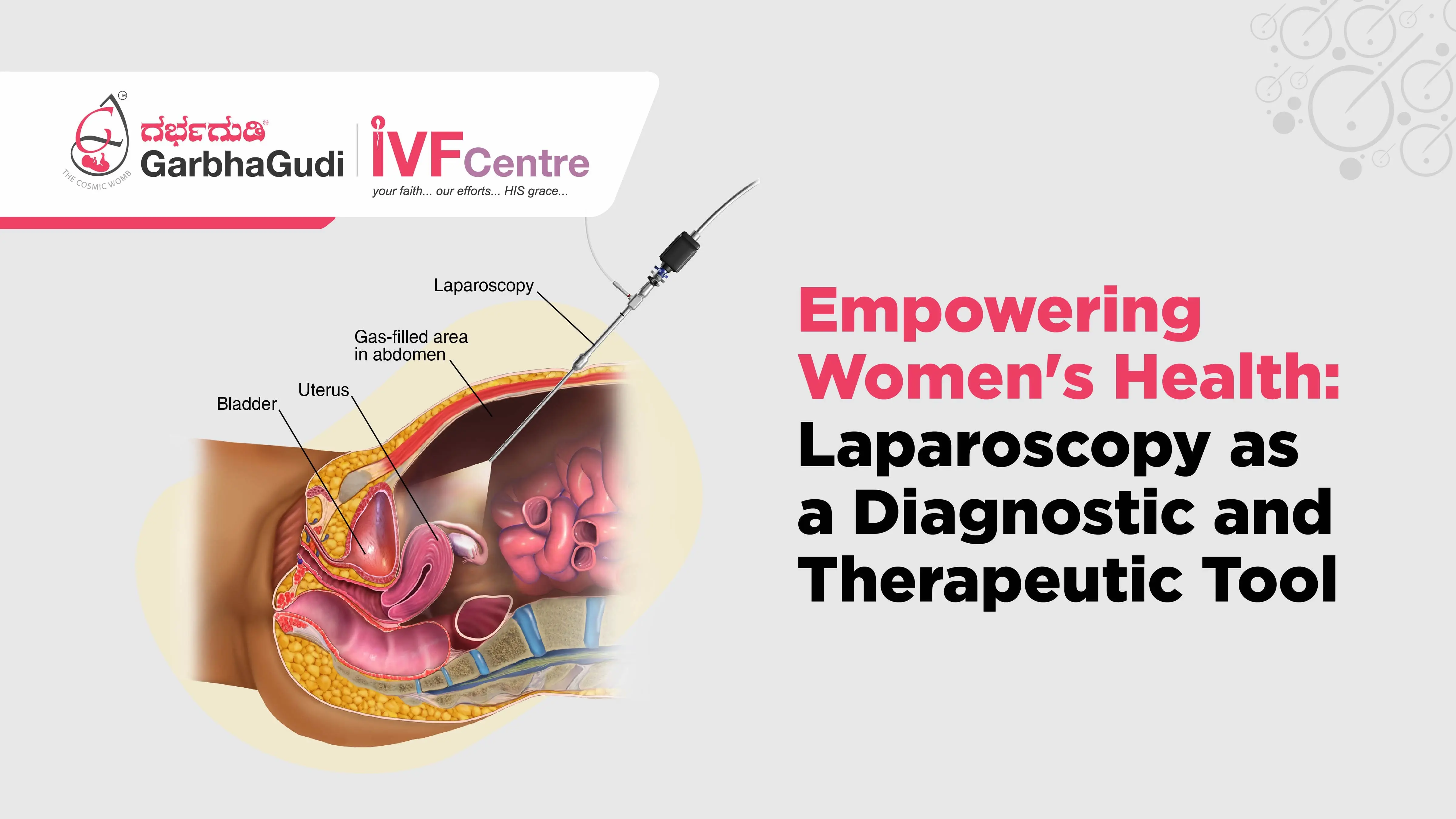 Laparoscopy in Women's Health: Diagnosis and Treatment